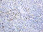 TYMP Antibody in Immunohistochemistry (Paraffin) (IHC (P))