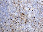 TYMP Antibody in Immunohistochemistry (Paraffin) (IHC (P))