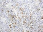 TYMP Antibody in Immunohistochemistry (Paraffin) (IHC (P))