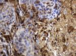 TYMP Antibody in Immunohistochemistry (Paraffin) (IHC (P))