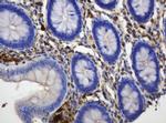 TYMP Antibody in Immunohistochemistry (Paraffin) (IHC (P))