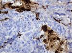 TYMP Antibody in Immunohistochemistry (Paraffin) (IHC (P))