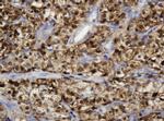 TYMP Antibody in Immunohistochemistry (Paraffin) (IHC (P))