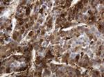 TYMP Antibody in Immunohistochemistry (Paraffin) (IHC (P))