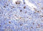 TYMP Antibody in Immunohistochemistry (Paraffin) (IHC (P))