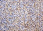 TYMP Antibody in Immunohistochemistry (Paraffin) (IHC (P))