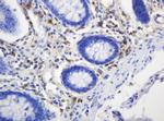 TYMP Antibody in Immunohistochemistry (Paraffin) (IHC (P))