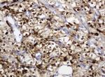 TYMP Antibody in Immunohistochemistry (Paraffin) (IHC (P))