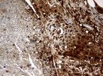 TYMP Antibody in Immunohistochemistry (Paraffin) (IHC (P))