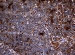 TYMP Antibody in Immunohistochemistry (Paraffin) (IHC (P))