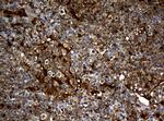 TYMP Antibody in Immunohistochemistry (Paraffin) (IHC (P))