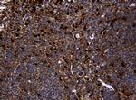 TYMP Antibody in Immunohistochemistry (Paraffin) (IHC (P))