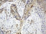 TYMP Antibody in Immunohistochemistry (Paraffin) (IHC (P))