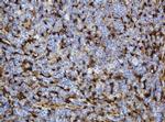 TYMP Antibody in Immunohistochemistry (Paraffin) (IHC (P))