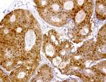 TYMP Antibody in Immunohistochemistry (Paraffin) (IHC (P))