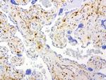 TYMP Antibody in Immunohistochemistry (Paraffin) (IHC (P))