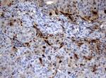 TYMP Antibody in Immunohistochemistry (Paraffin) (IHC (P))