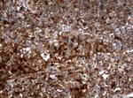 TYMP Antibody in Immunohistochemistry (Paraffin) (IHC (P))