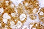 TYMP Antibody in Immunohistochemistry (Paraffin) (IHC (P))