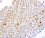 TYMP Antibody in Immunohistochemistry (Paraffin) (IHC (P))