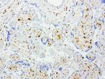 TYMP Antibody in Immunohistochemistry (Paraffin) (IHC (P))