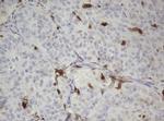 TYMP Antibody in Immunohistochemistry (Paraffin) (IHC (P))