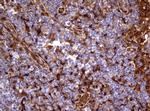 TYMP Antibody in Immunohistochemistry (Paraffin) (IHC (P))