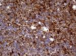 TYMP Antibody in Immunohistochemistry (Paraffin) (IHC (P))