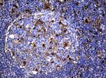 TYMP Antibody in Immunohistochemistry (Paraffin) (IHC (P))