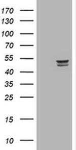 TYMP Antibody in Western Blot (WB)