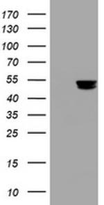 TYMP Antibody in Western Blot (WB)