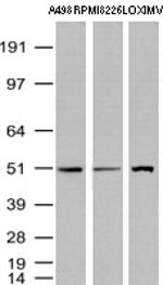 TYMP Antibody in Western Blot (WB)