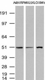 TYMP Antibody in Western Blot (WB)