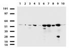 TYMP Antibody in Western Blot (WB)