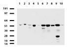 TYMP Antibody in Western Blot (WB)