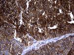 TYMS Antibody in Immunohistochemistry (Paraffin) (IHC (P))