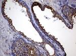 TYMS Antibody in Immunohistochemistry (Paraffin) (IHC (P))