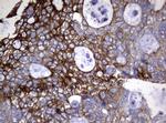 TYMS Antibody in Immunohistochemistry (Paraffin) (IHC (P))