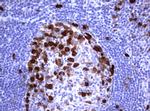 TYMS Antibody in Immunohistochemistry (Paraffin) (IHC (P))