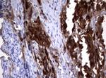 TYMS Antibody in Immunohistochemistry (Paraffin) (IHC (P))