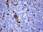 TYMS Antibody in Immunohistochemistry (Paraffin) (IHC (P))