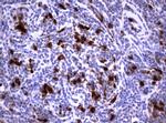 TYMS Antibody in Immunohistochemistry (Paraffin) (IHC (P))