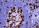 TYMS Antibody in Immunohistochemistry (Paraffin) (IHC (P))