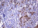 TYMS Antibody in Immunohistochemistry (Paraffin) (IHC (P))