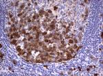 TYMS Antibody in Immunohistochemistry (Paraffin) (IHC (P))