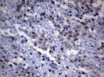 TYMS Antibody in Immunohistochemistry (Paraffin) (IHC (P))