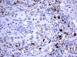 TYMS Antibody in Immunohistochemistry (Paraffin) (IHC (P))