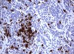 TYMS Antibody in Immunohistochemistry (Paraffin) (IHC (P))