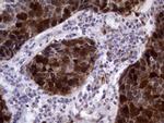 TYMS Antibody in Immunohistochemistry (Paraffin) (IHC (P))