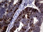 TYMS Antibody in Immunohistochemistry (Paraffin) (IHC (P))